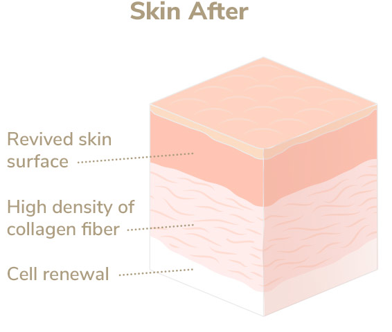 Skin after Elevare