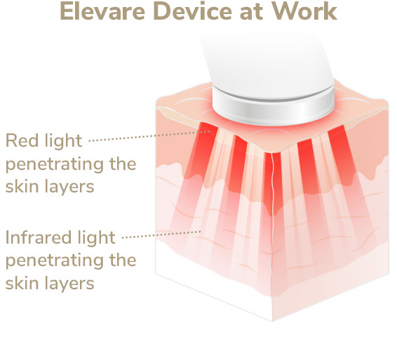 Elevare device at work